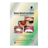 Image of Varian normal lesi mulut : kondisi klinis yang paling sering diinterpretasikan sebagai keganasan